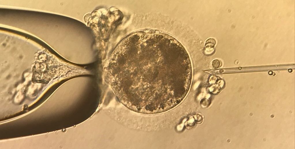 Palenque Brillito: el caballo argentino que nació con técnicas de fertilización desarrolladas para humanos 2 IMG 2139 e1540559086432