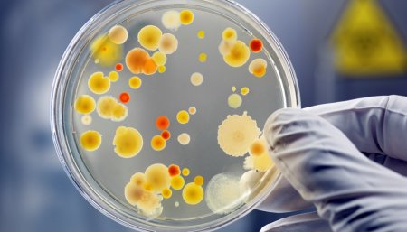 colonias en capsula de petri